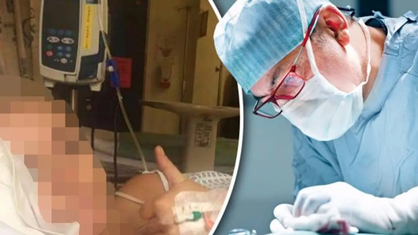 Műtéti úton kellett eltávolítani a rezgő segédeszközt és ez még nem minden 