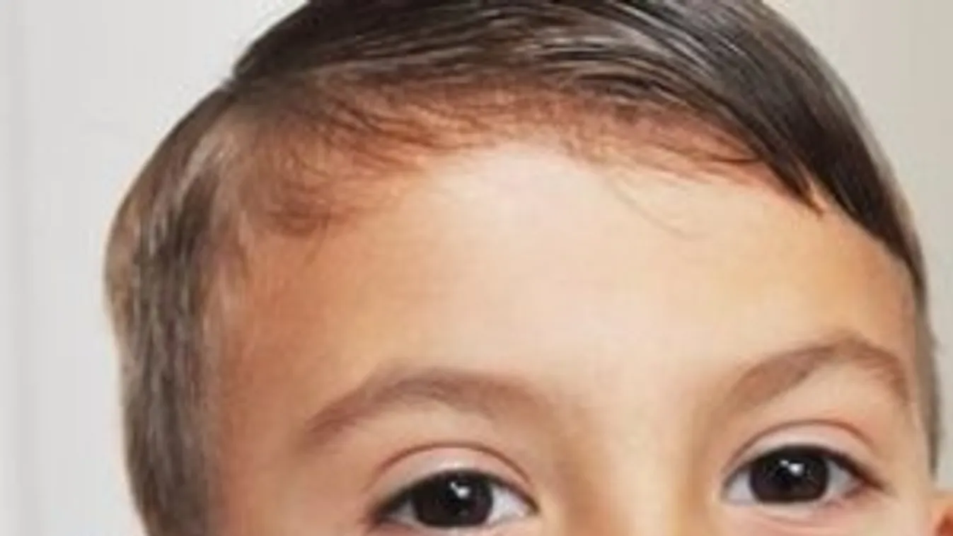 Kiverték a fogát az iskolában, kapott egy matricát cserébe
