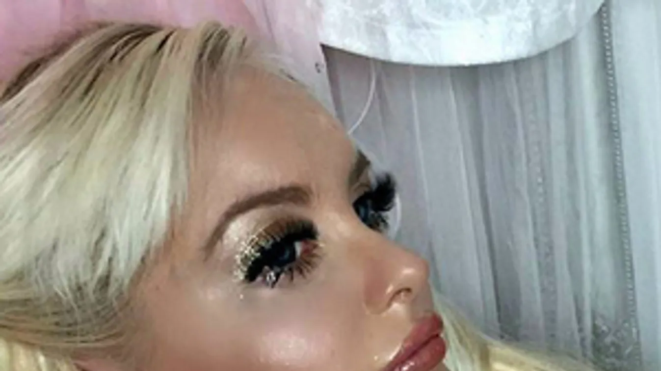 Barbie-ként él a kilencévesen lebénult lány - fotók