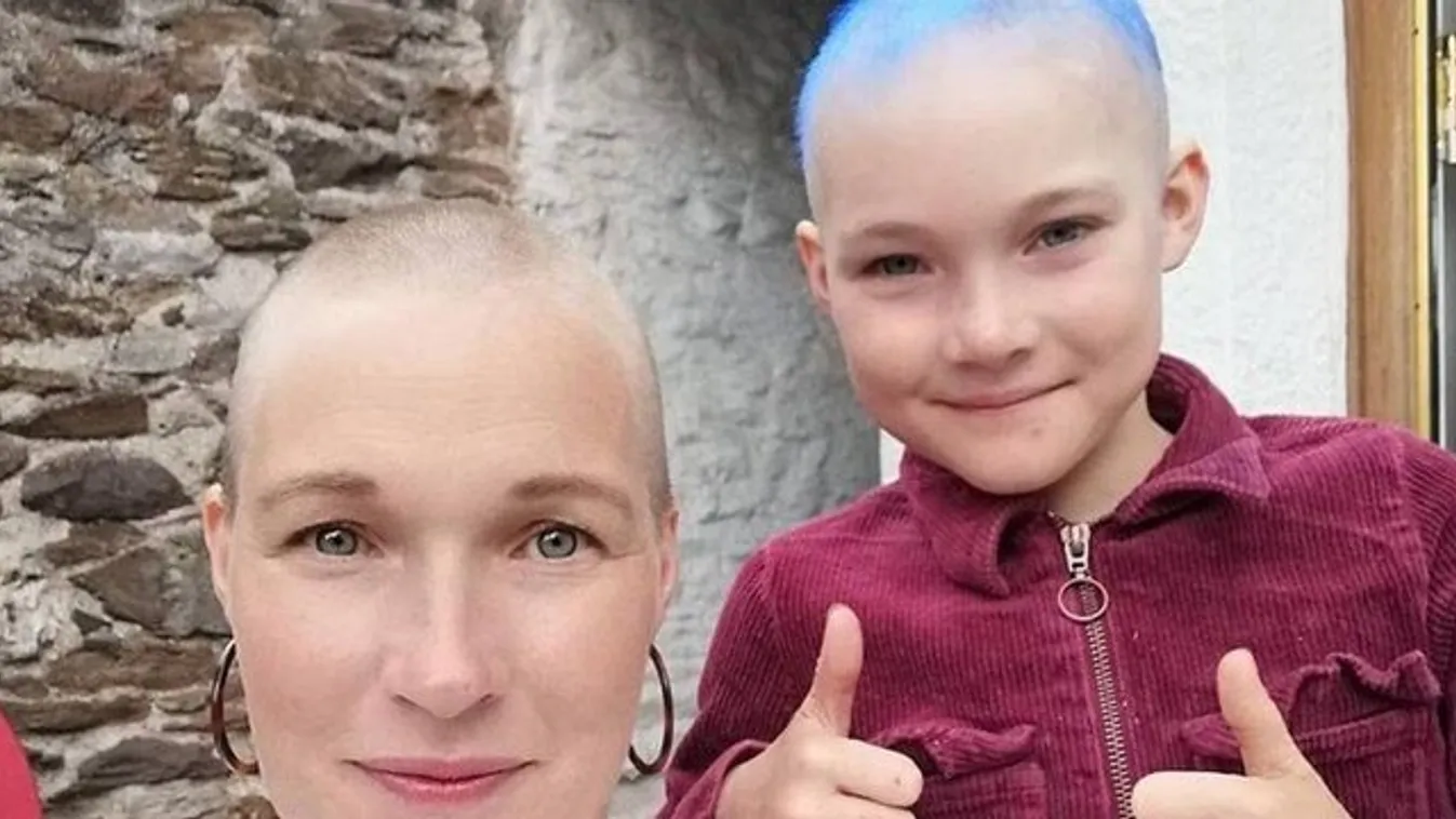 Könnyfakasztó: A koronavírus okozta stressz miatt hullott ki a tündéri kilencéves kislány haja