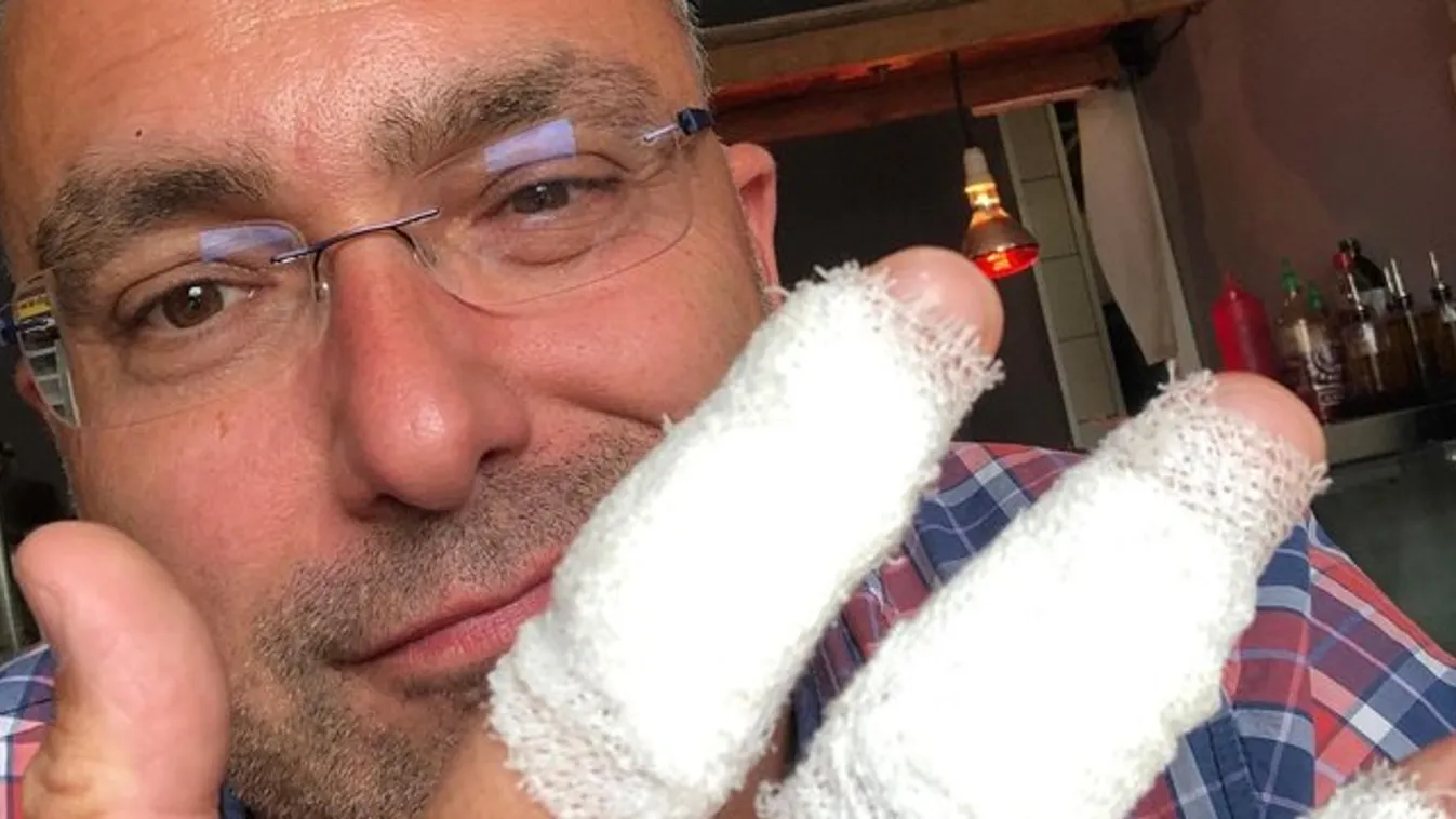 Három ujját vágta el Sváby András