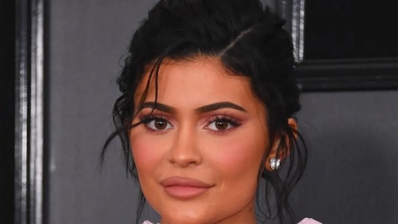 Kylie Jenner már nem rejtegeti a szexi lábán éktelenkedő sebhelyet