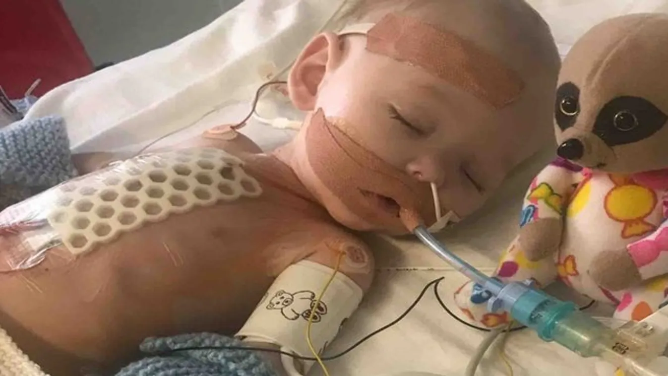 Háromszor majdnem meghalt a tévesen diagnosztizált négy hónapos baba