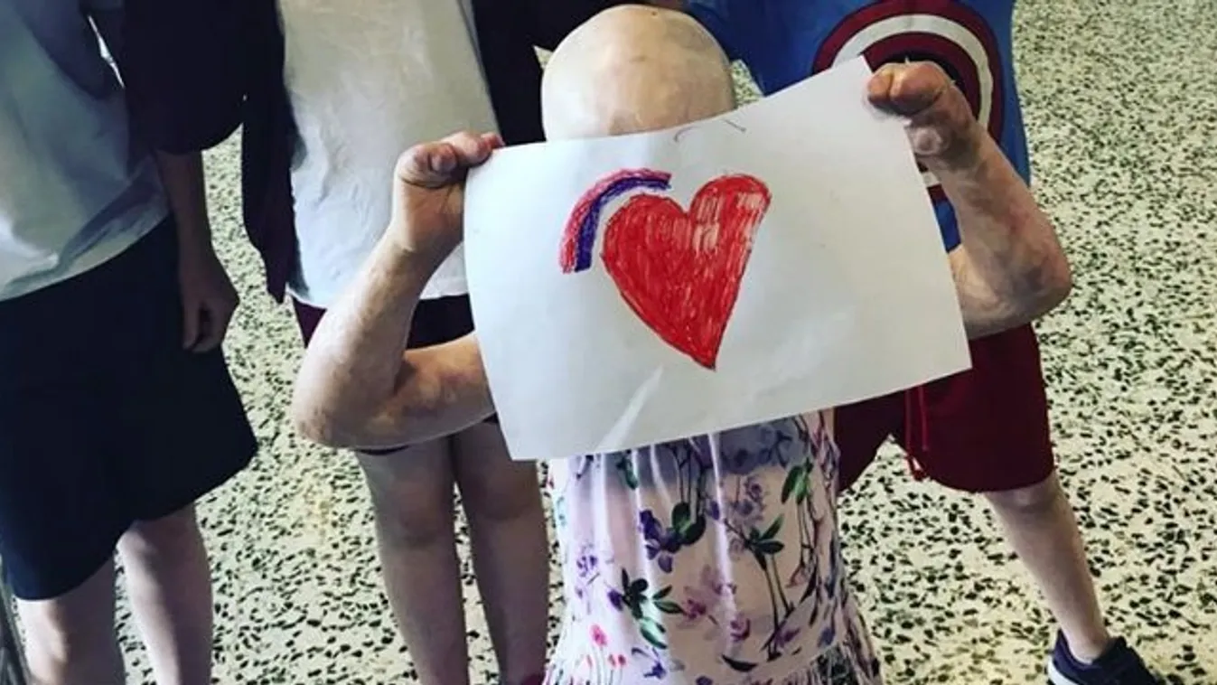 Mindenhonnan elűzik a családot, mert a többi szülő szerint túl ronda a kislányuk