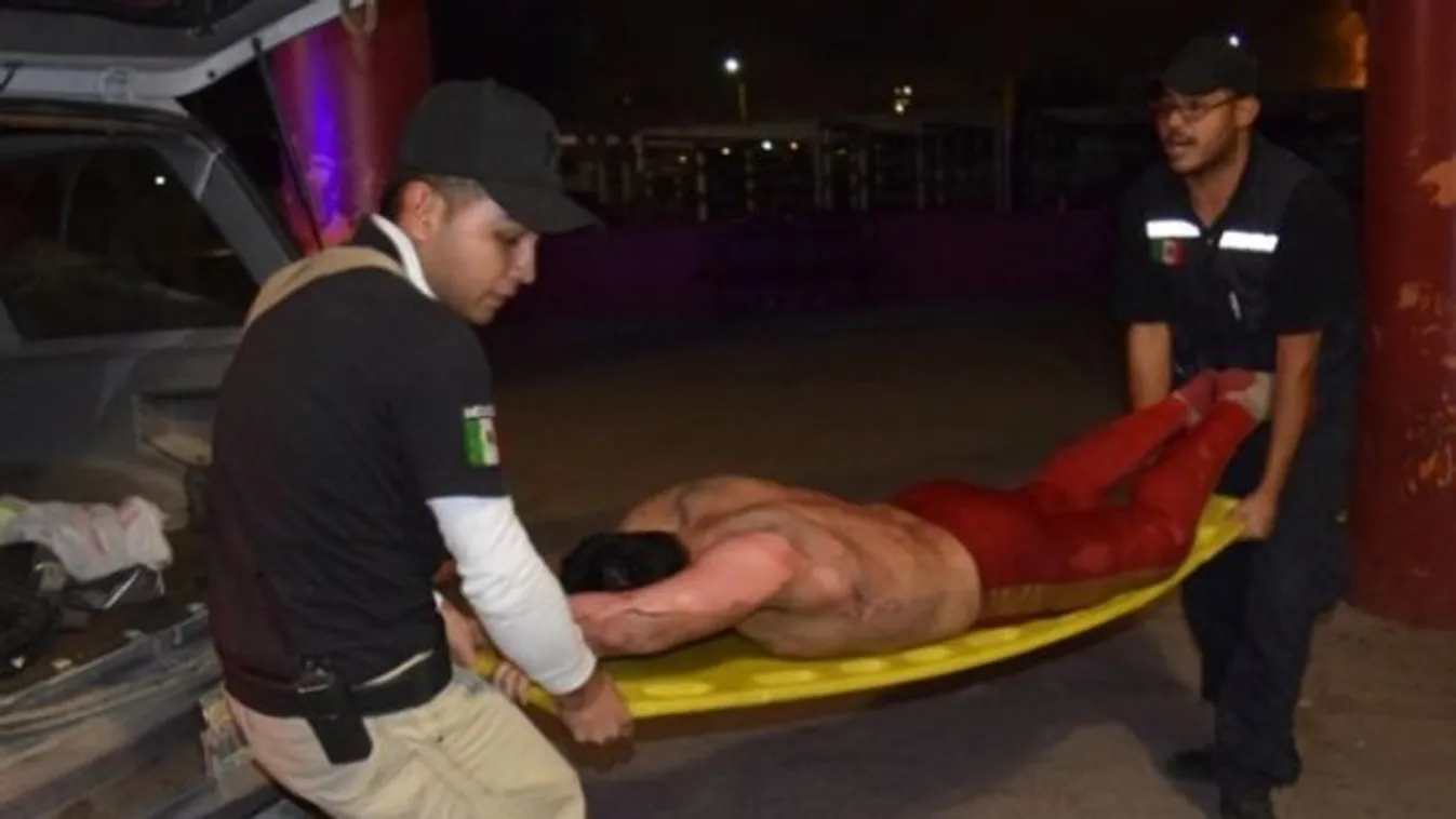 Horror! Durván megégett a pankrátor - videó