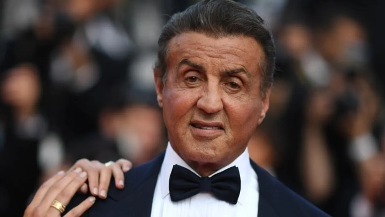 Durva fotó! Véres fejjel mesélte el Stallone, mi történt vele