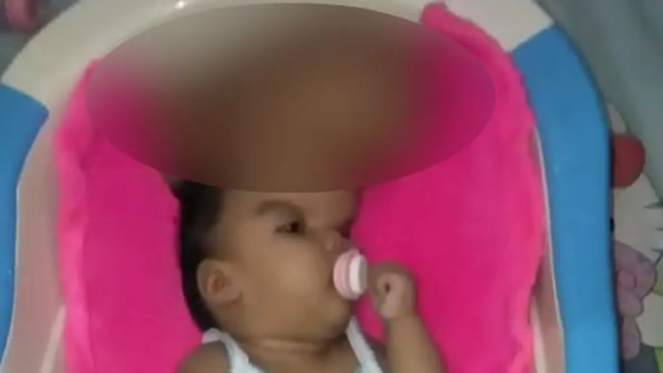 Brutális elváltozás veszélyezteti a csecsemőt - a szülők kétségbeesett gyűjtésbe kezdtek - 18+ videó