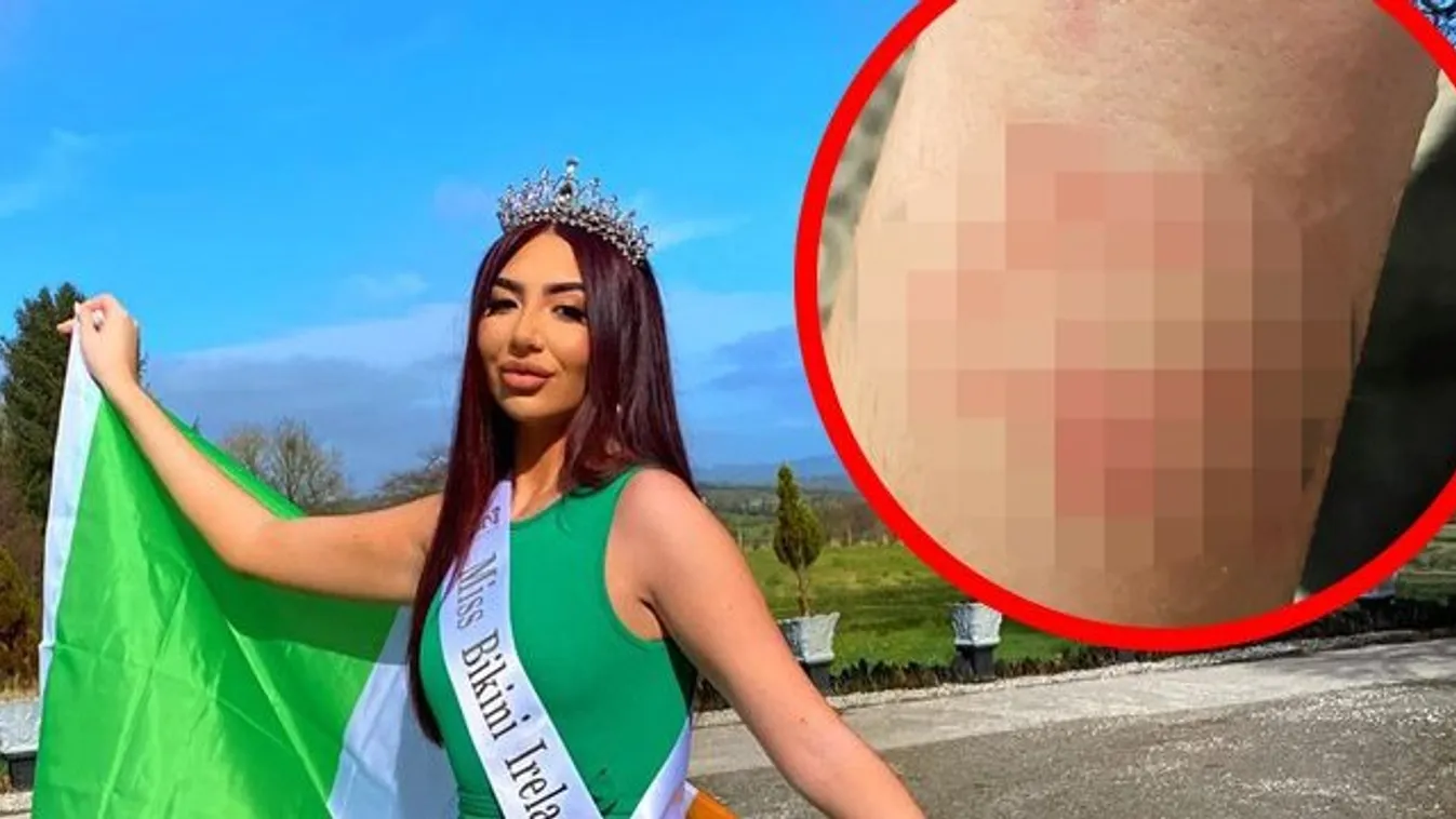 Brutális sérüléseivel bizonyítja a bikinimodell: kísértetek támadtak rá – fotók