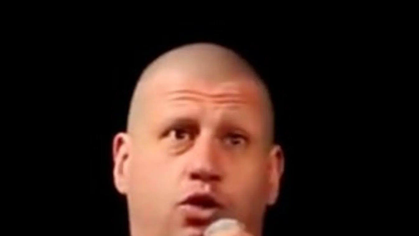 Puzsér Róbert önsebzés miatt tolta le a haját és a szemöldökét