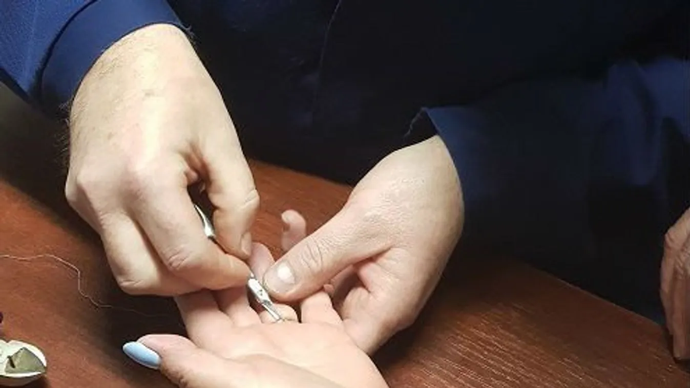 Gyűrűk eltávolításában kérte egy hölgy a tűzoltók segítségét
