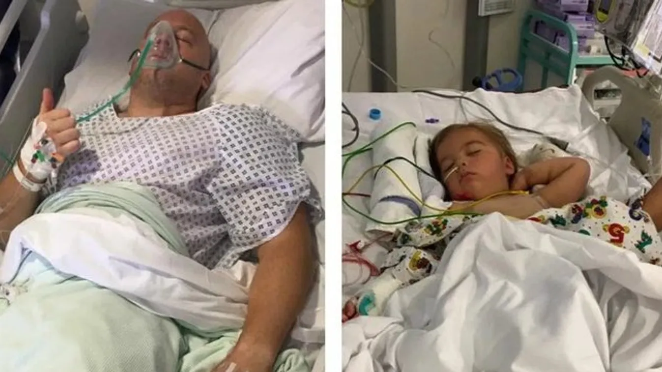 Hároméves, stroke-ot kapott kislányának adta a veséjét az apa