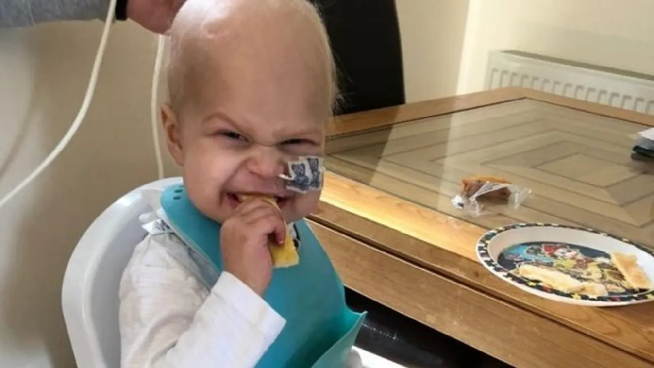 Az életéért küzd egy 2 éves kisfiú: ritka agydaganat támadta meg