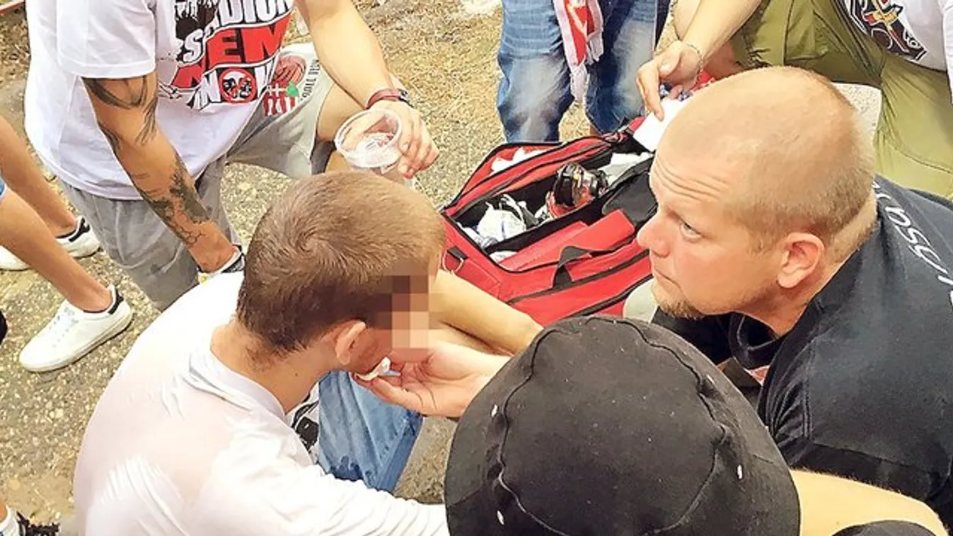 Nemcsak horzsolások voltak: ripityára tört a szurkoló állkapcsa