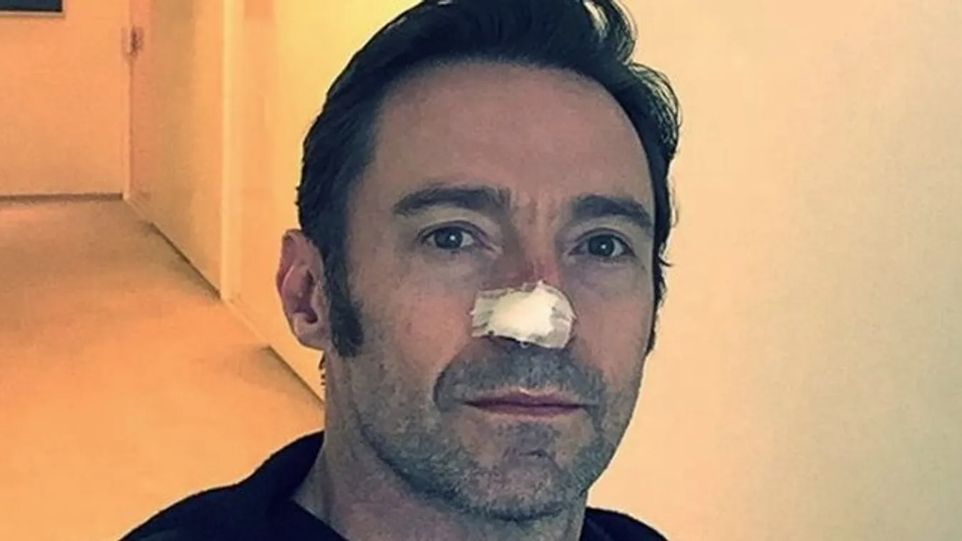 Kiújult Hugh Jackman rákja