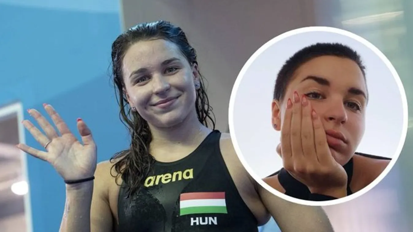 Testképzavara miatt vágatta le a haját Késely Ajna