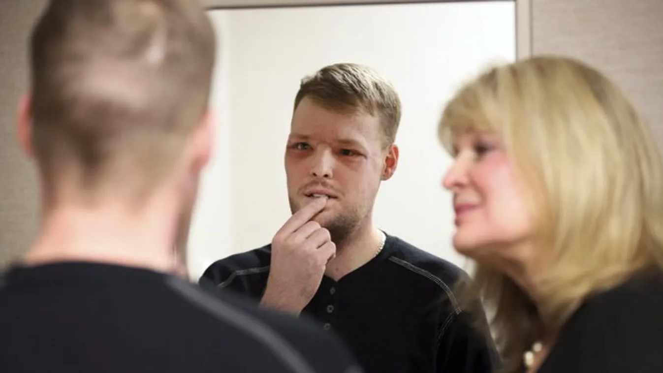 Csoda: új arcot kapott, miután fejbe lőtte magát