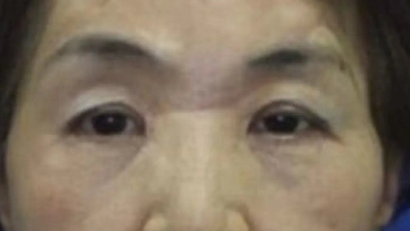 Megskalpolta a fonógép a japán munkást