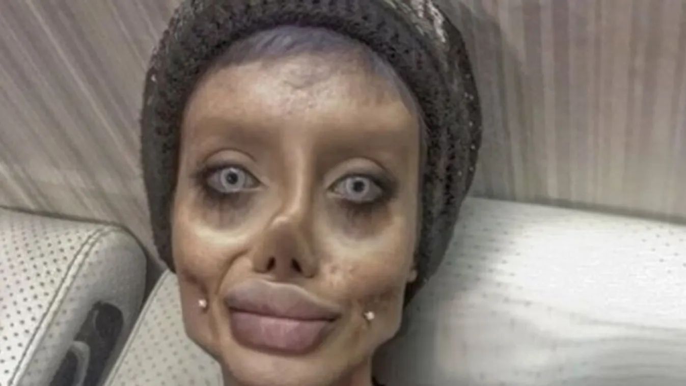 Igazi szörny lett a nőből, aki Angelina Jolie-ra akart hasonlítani – fotók