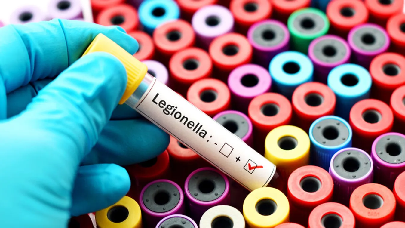 Milyen tünetekről lehet felismerni a legionella-fertőzést?