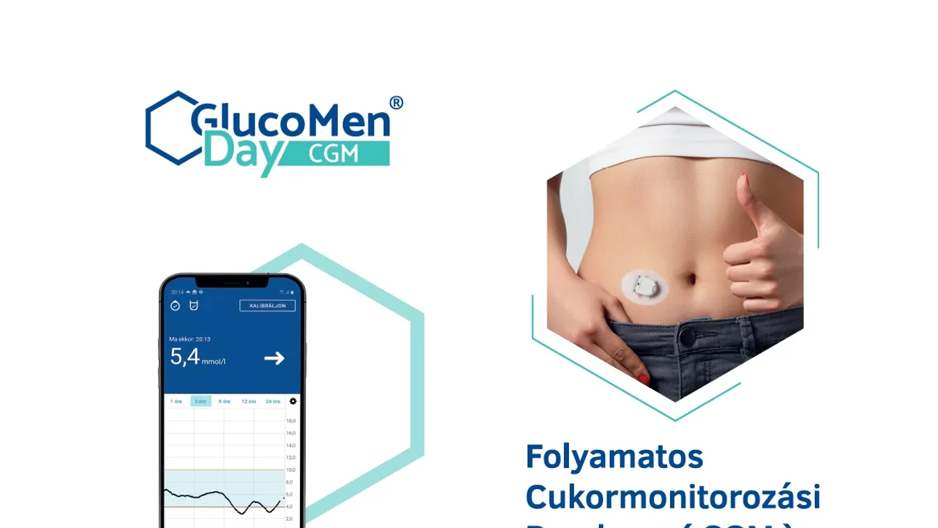 Percenként mérő, folyamatos cukormonitorozó rendszer került a piacra