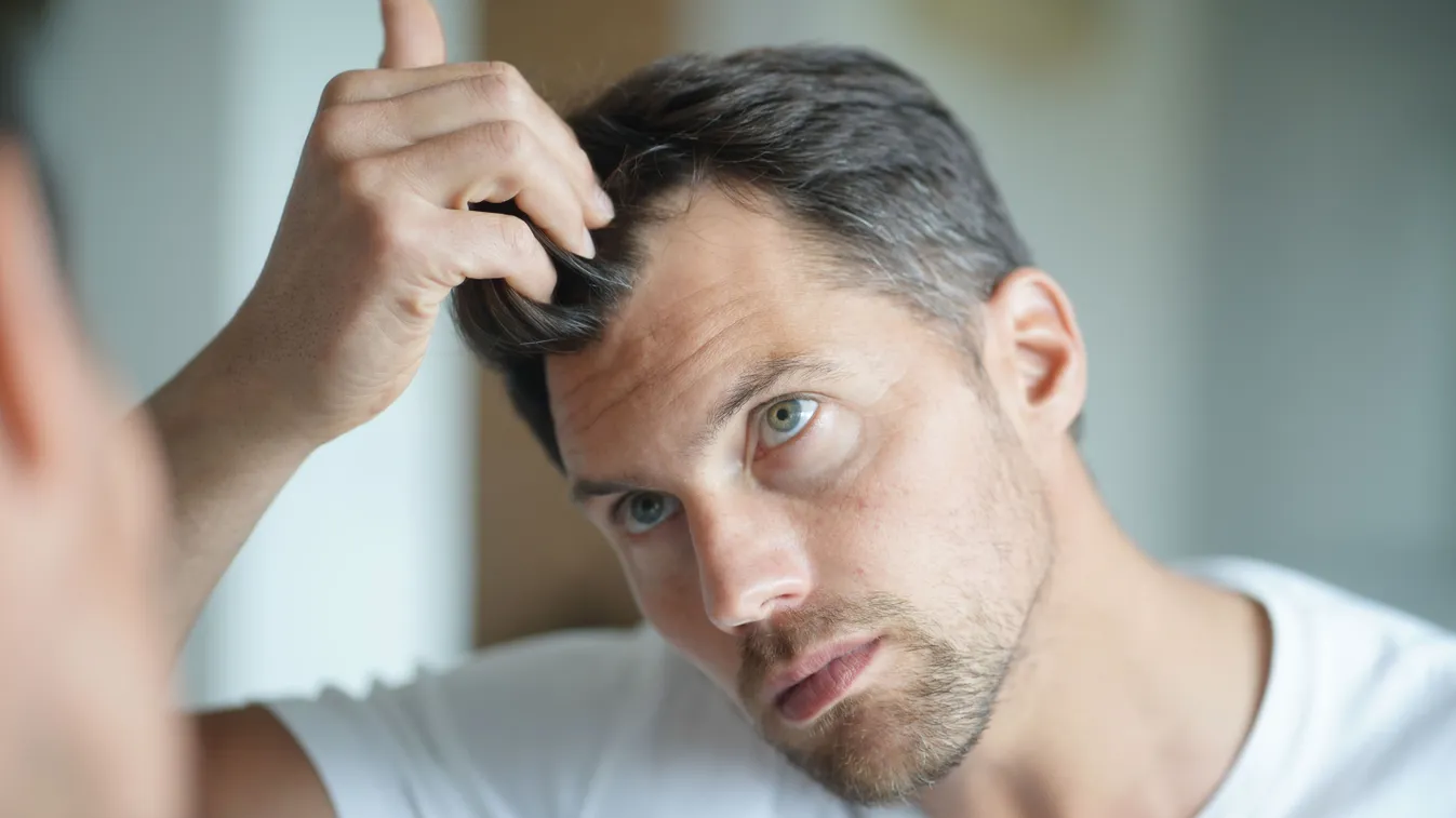 Portrait,Of,A,Man,Worried,About,Hair,Loss