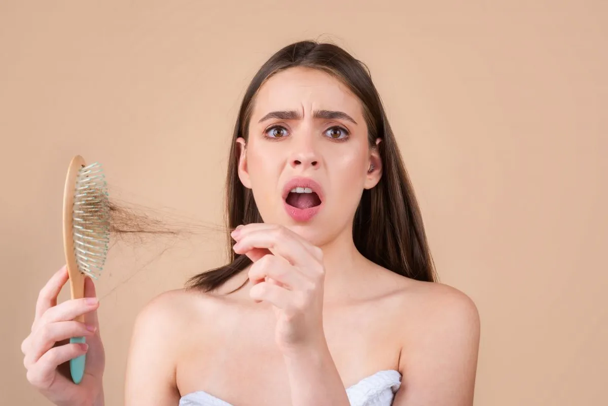 Hair,Loss,Woman,With,A,Comb,And,Problem,Hair.,Hairloss