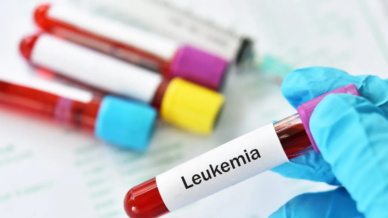 Jelentős előrelépés a leukémia kezelésében