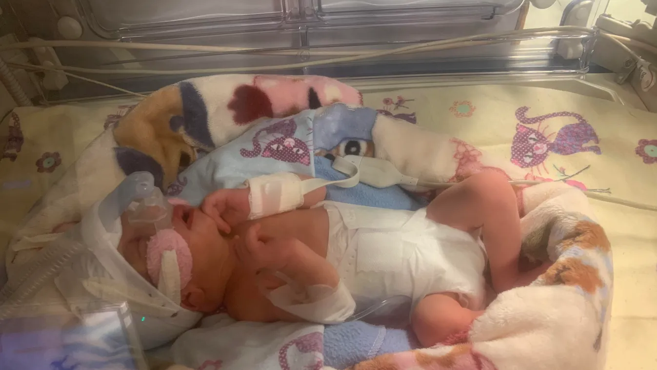 A 34. héten derült ki, hogy a kisfiam nagyon beteg