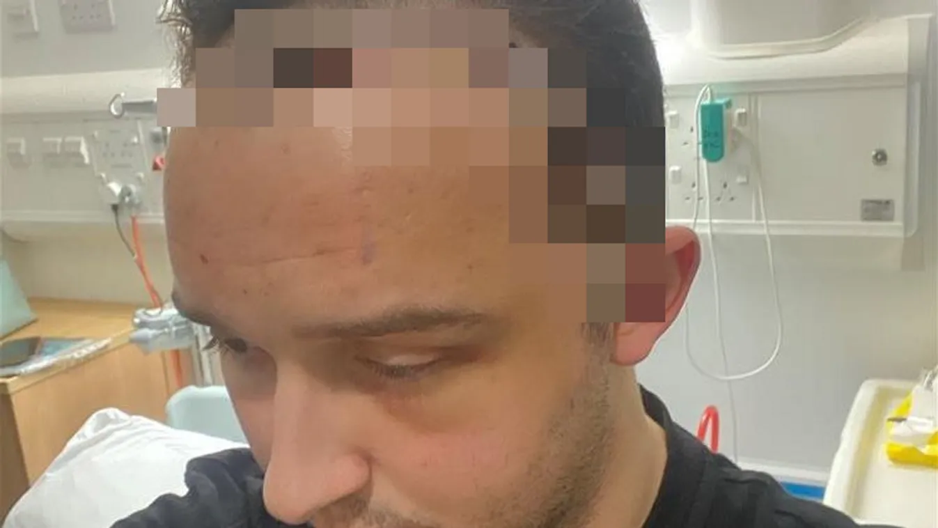 Fájdalomcsillapítóval kezelték a fiatal férfit, később derült csak ki a megrázó diagnózis – 18+