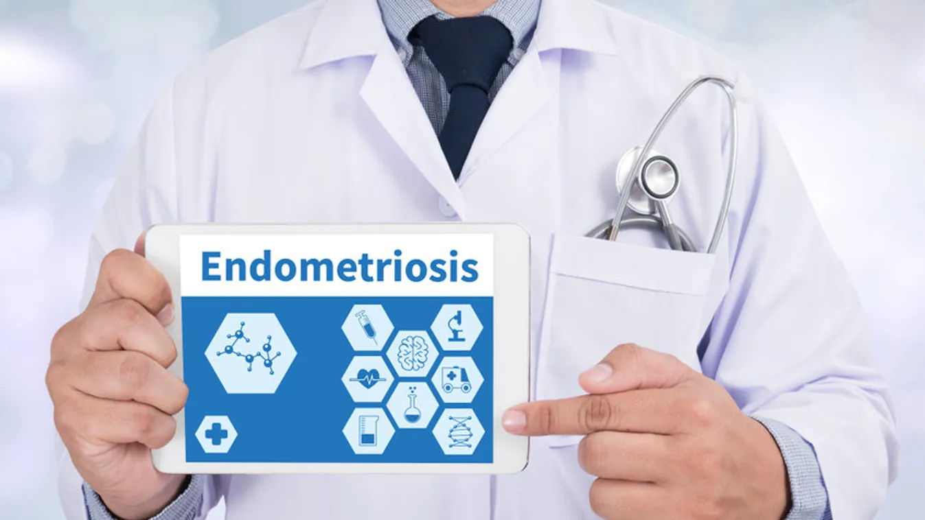 Endometriózis – Tények és tévhitek a betegségről     1.rész