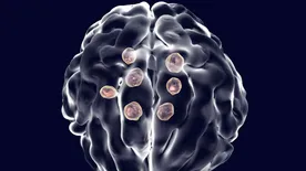 Agyhártyagyulladás, tüdőbetegségek - Életveszélyes gombafajokra hívta fel a figyelmet a WHO