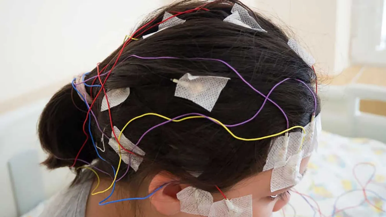 Forradalmian új eszköz az epilepsziás rohamokkal küzdők számára