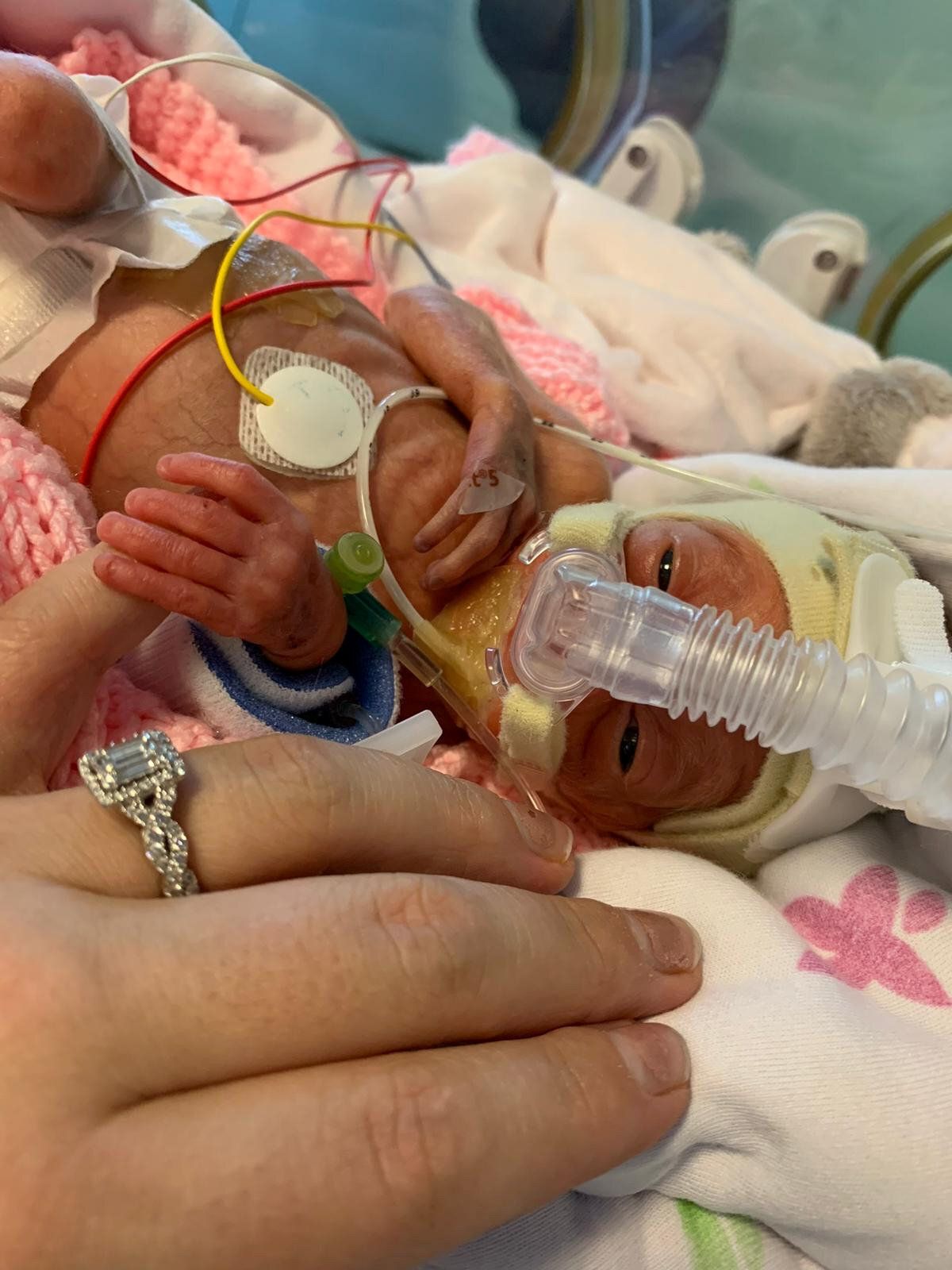 Premature Baby Who Weighed Less Than 1kg When Born Will Get To Experience Her First Christmas
