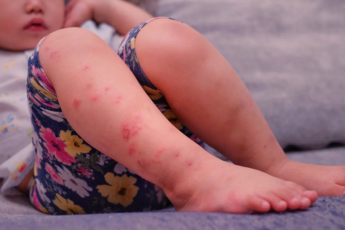 A,Young,Asian,Girl,With,Either,Tomato,Flu,Or,Hand