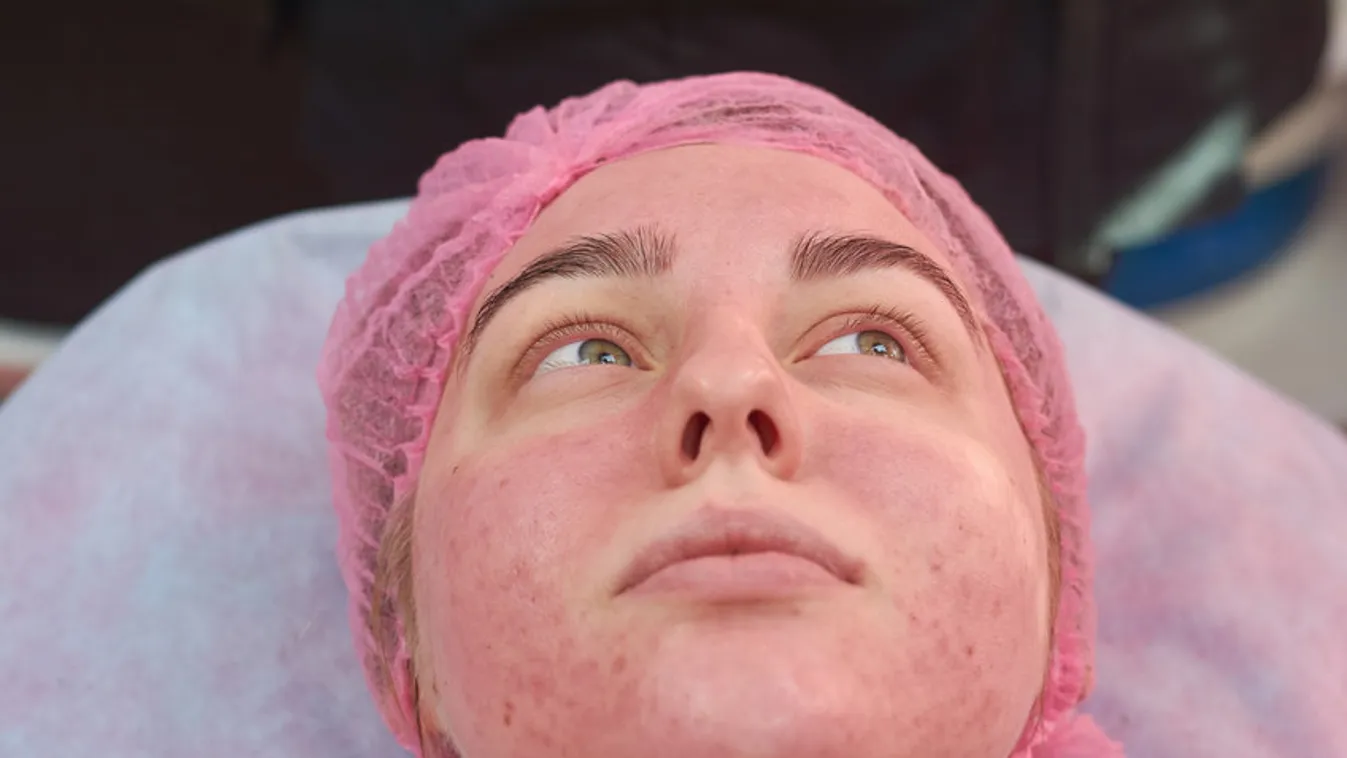 Mi a lupus és milyen tünetekkel jár?