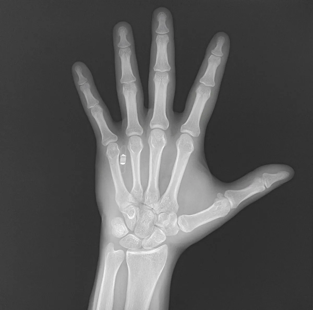 Futuristic Walletmor Implant Allows Users To Pay Using A Wave Of Their Hands