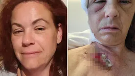 Ha ilyet tapasztalsz azonnal keresd fel fogorvosod