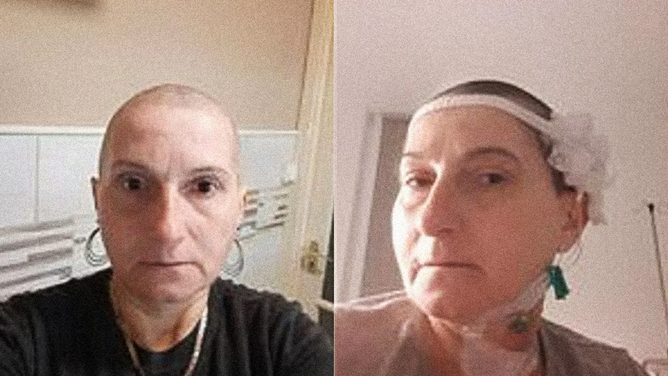 "Próbáltam pozitív lenni, nem sírni előttük" – Beáta elmesélte, hogy győzte le a rákot