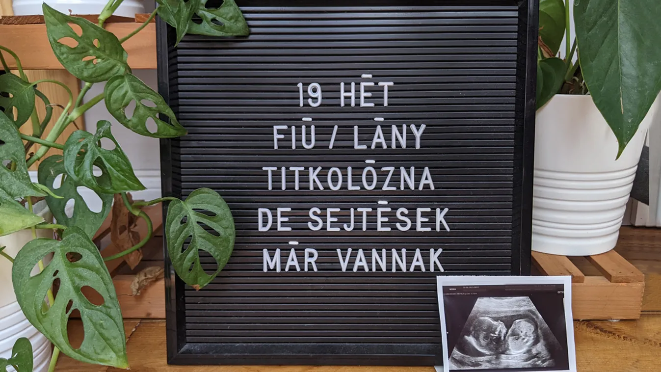 Terhesnapló: Kiteregetjük a szennyest!