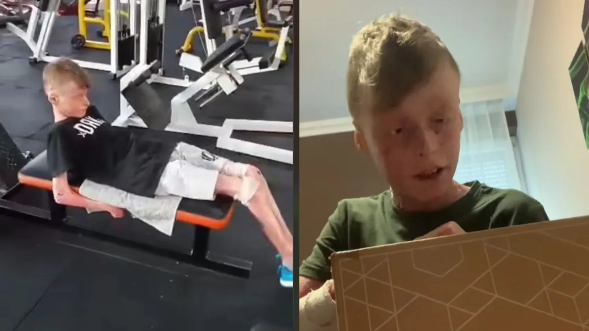 Vass Flórián, bőrbeteg tini, fotó: TikTok videógrab