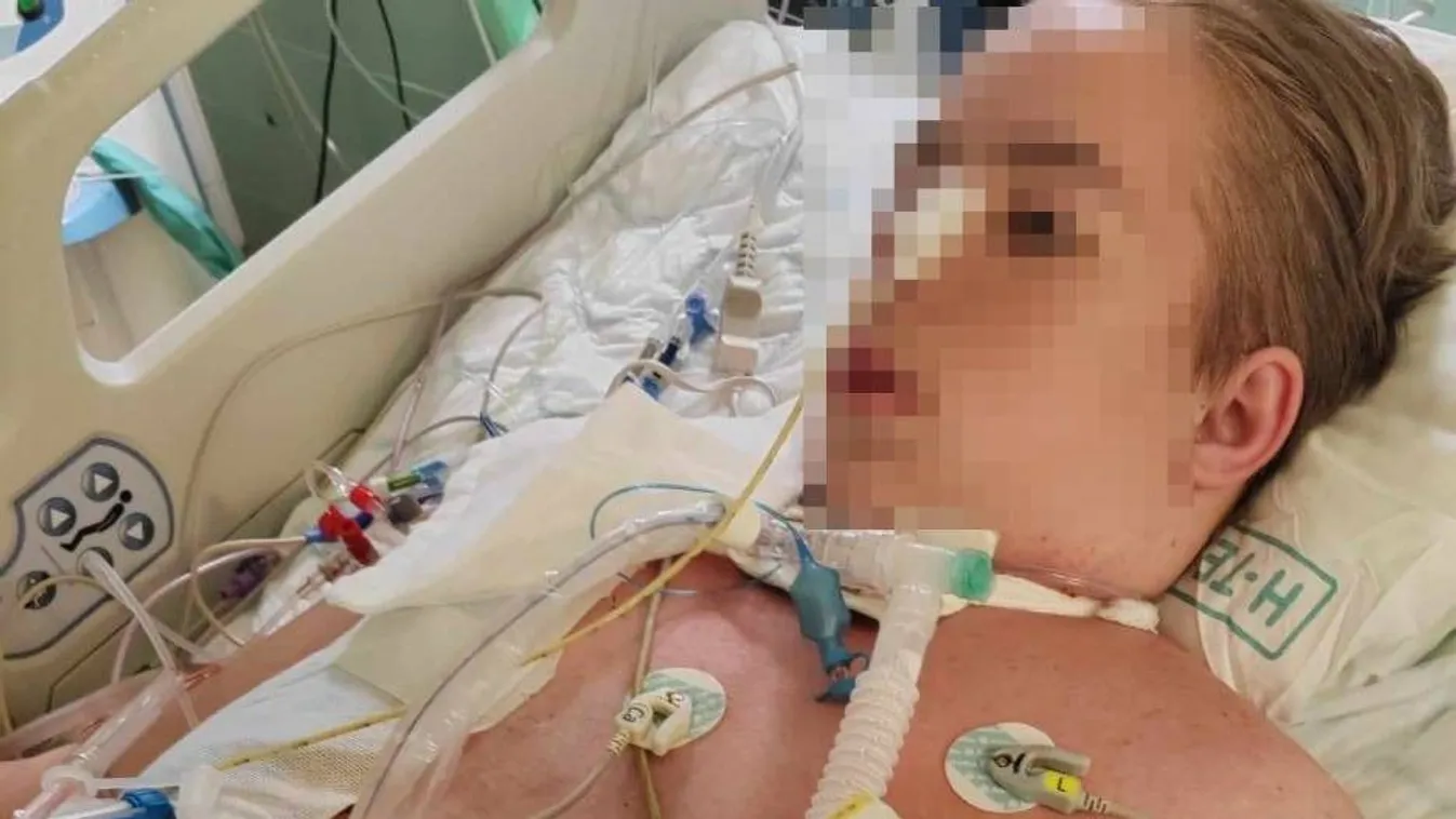 "Anya... nagyon fáj, könyörgöm segíts" – Rutin műtétnek indult, most az életéért küzd a 15 éves Dominik