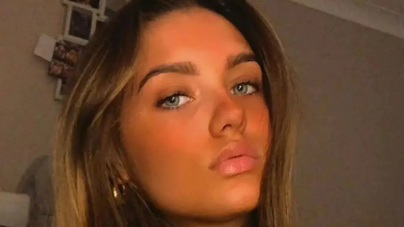 „Olyanná vált, mint egy sétáló csontváz” - ritka betegséggel küzd a fiatal lány, ezek voltak az intő jelek