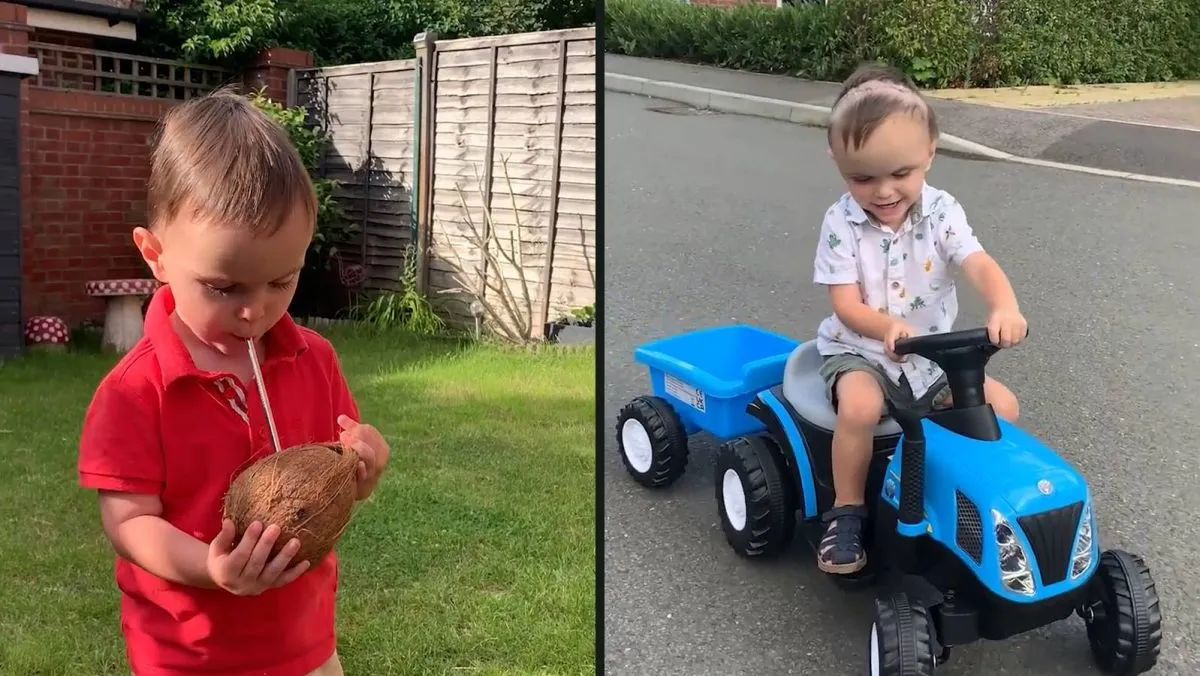 Oliver, koponyafejlődési rendellenesség