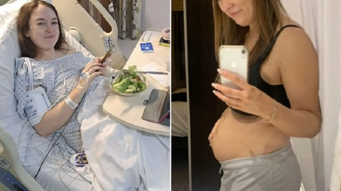 „Már szorongtam a fájdalomtól” – Öt hónapos terhesnek tűnt egy nő, sokkoló, mi állt a háttérben