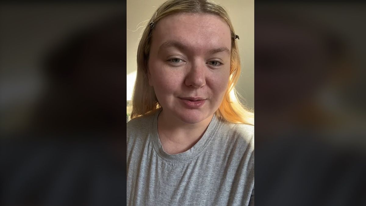 „Szerencsém, hogy életben vagyok” - A világ legritkább betegségével küzd a 21 éves Alicia