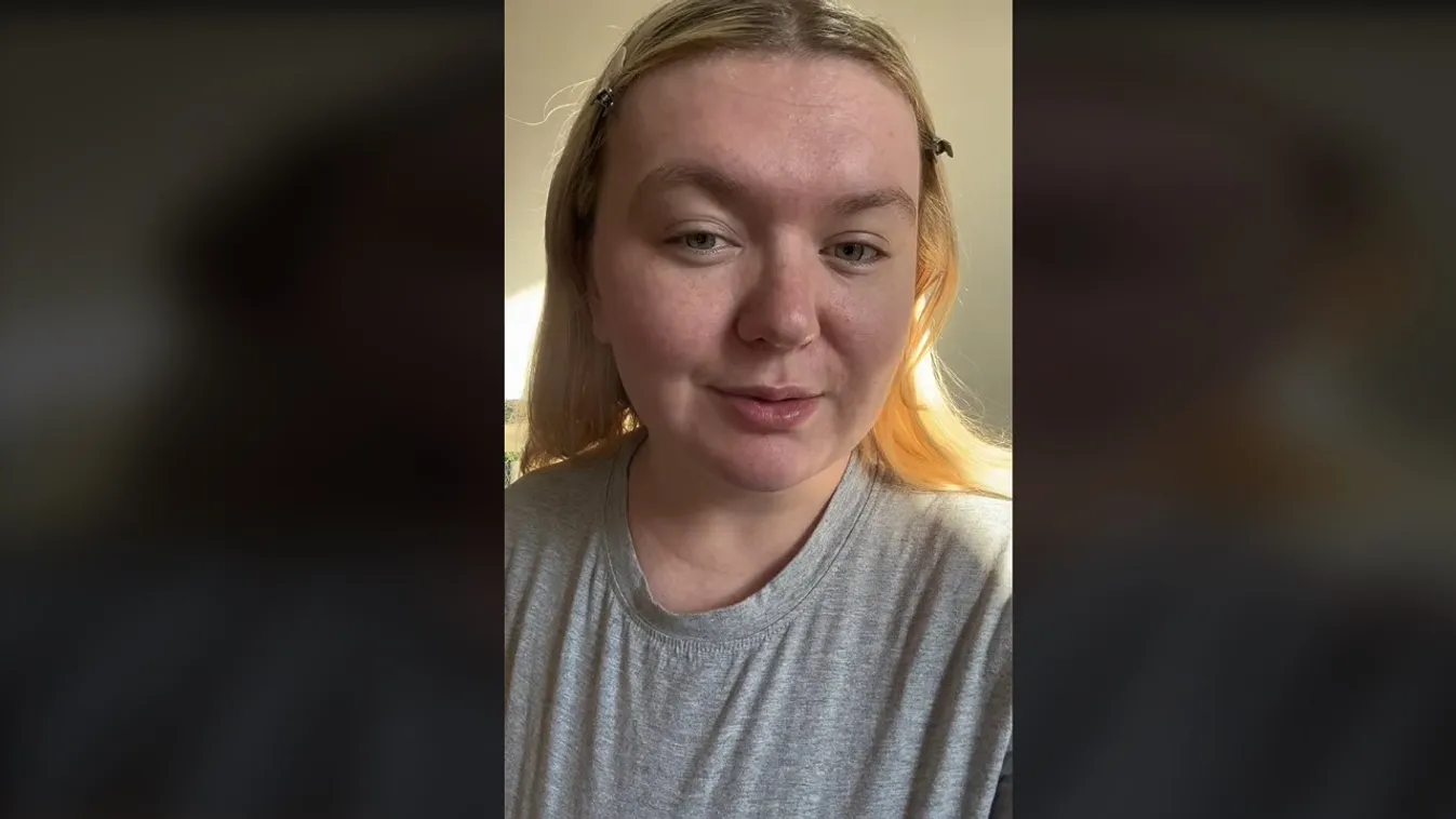 „Szerencsém, hogy életben vagyok” - A világ legritkább betegségével küzd a 21 éves Alicia