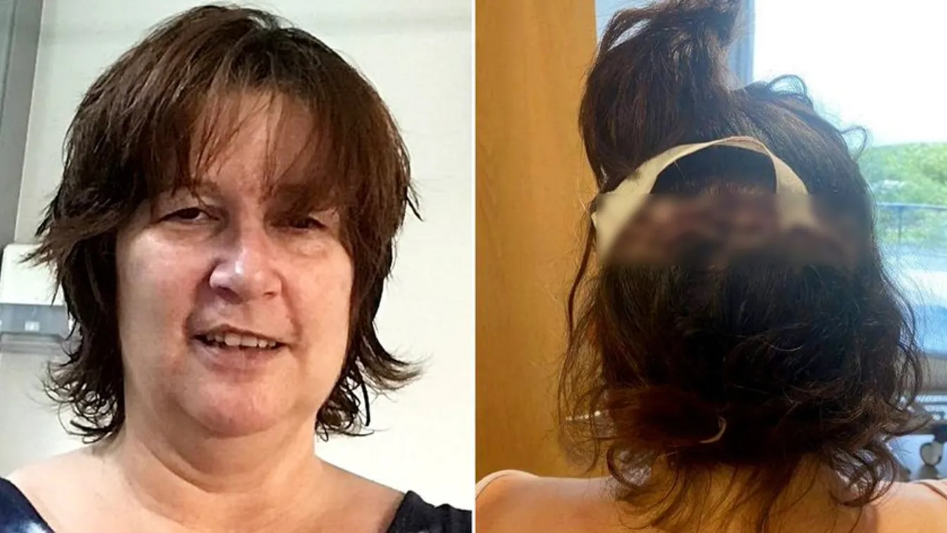 Felfoghatatlan tragédia: ritka agyfertőzés miatt ölte meg a férjét egy nő