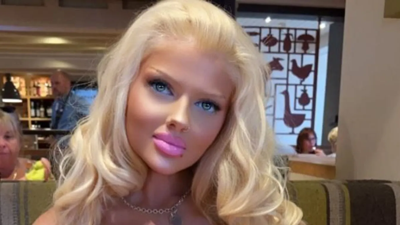 "4 milliót költöttem plasztikai műtétre, hogy úgy nézzek ki, mint Barbie – de a trollok bohócnak hívnak"