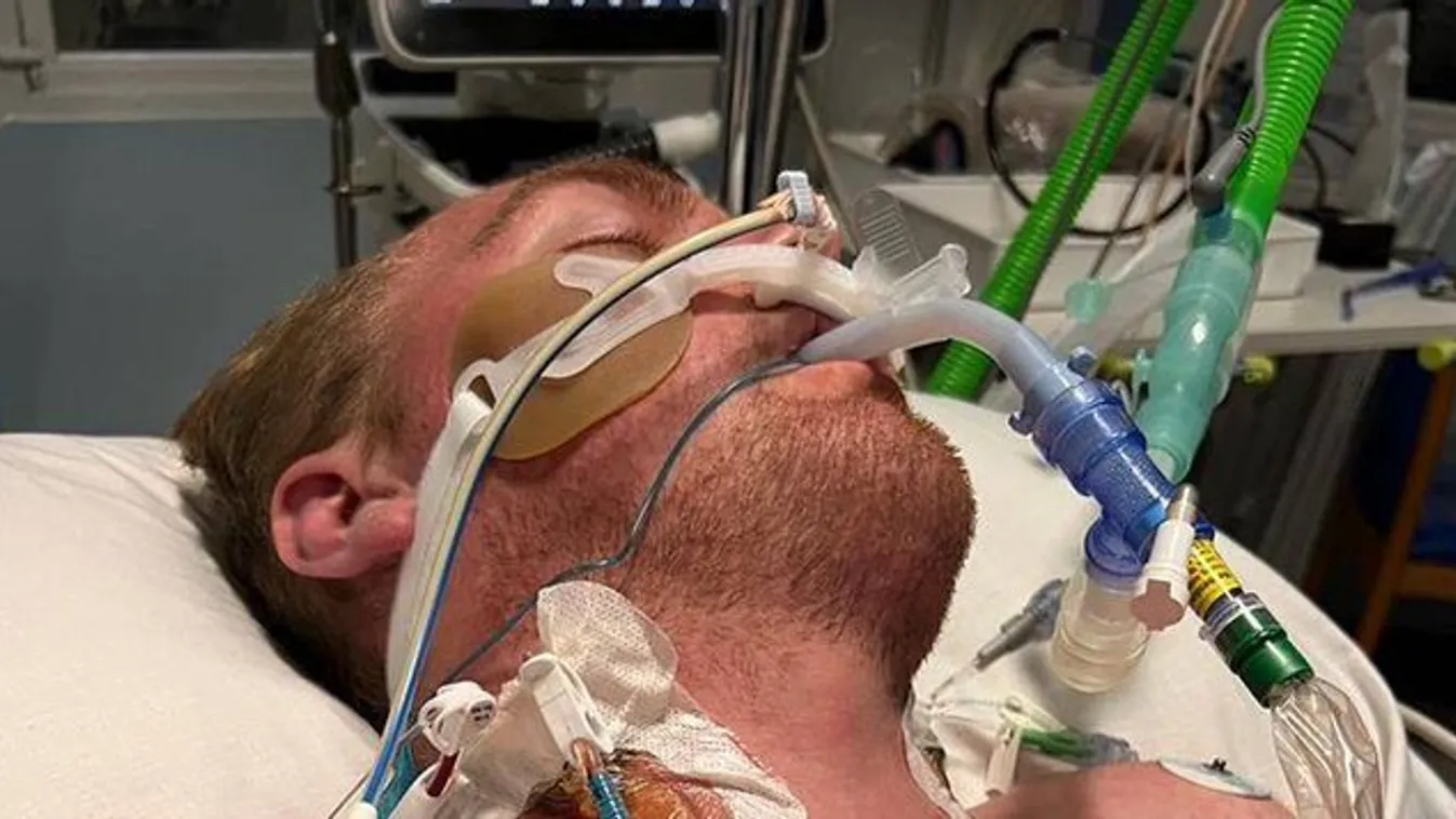 "Agykárosodást kapott a fiam, miután a fejfájás egy ritka betegség jele volt"