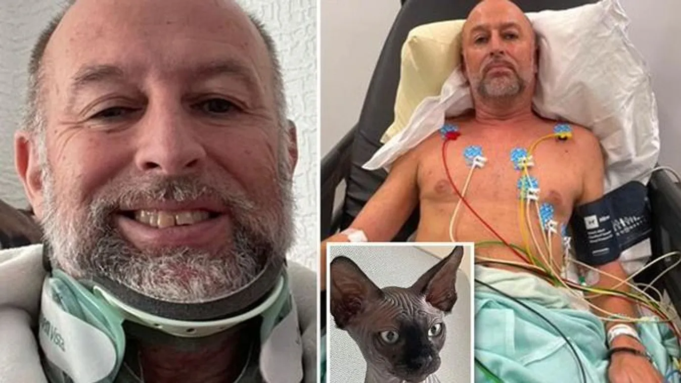 „Csoda, hogy élek: olyan sérüléseket szenvedtem, mint akin áthajtott egy autó, miután megbotlottam a macskámban”